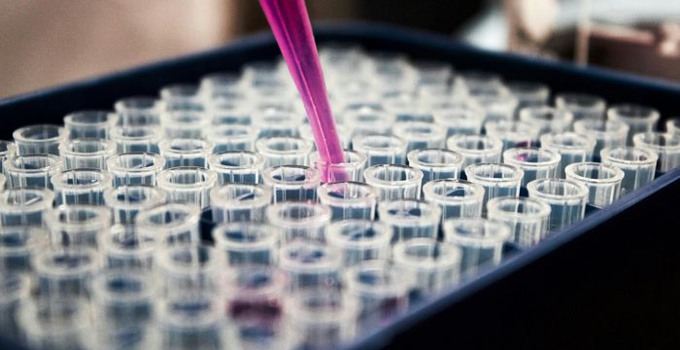 Pipett och provrör.